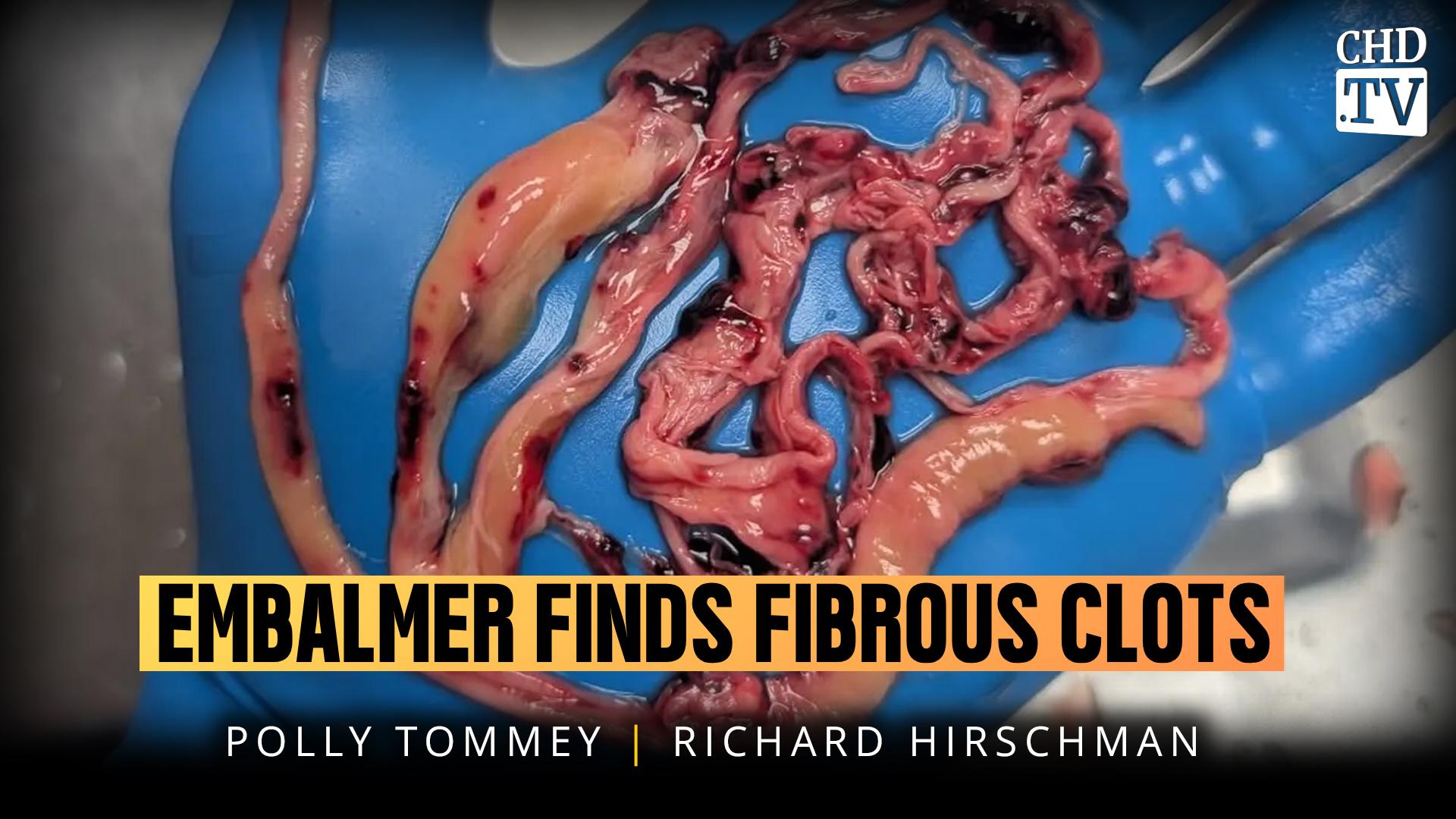Embalmer Finds Fibrous Clots + Residents Fight Cell Tower Construction